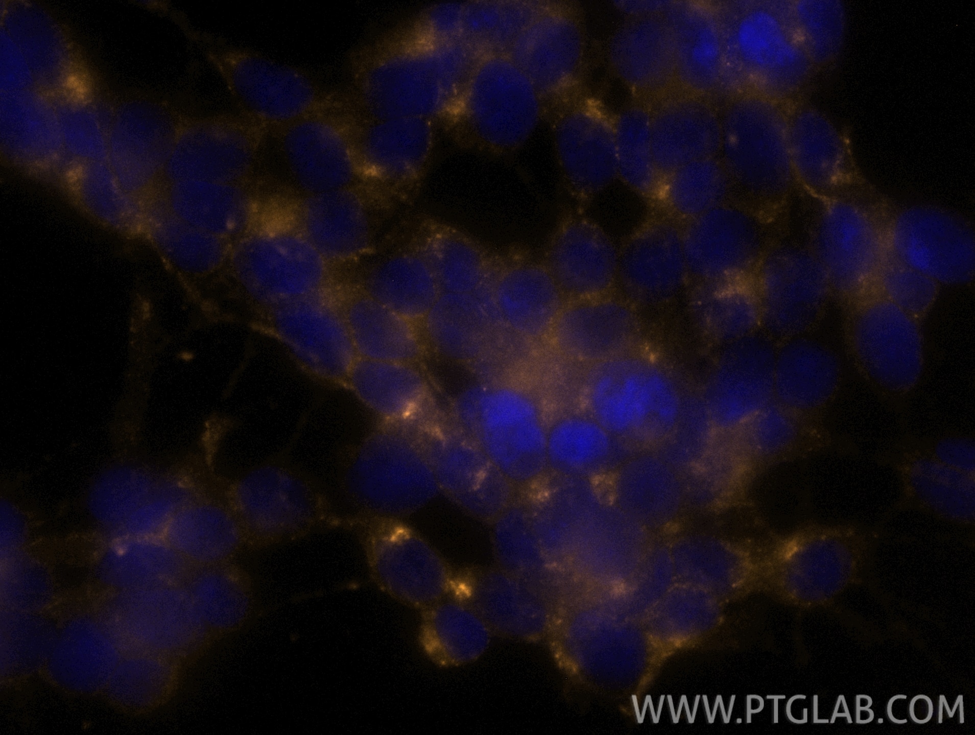 Immunofluorescence (IF) / fluorescent staining of SH-SY5Y cells using CoraLite® Plus 555-conjugated STMN2 Recombinant an (CL555-82925-2)