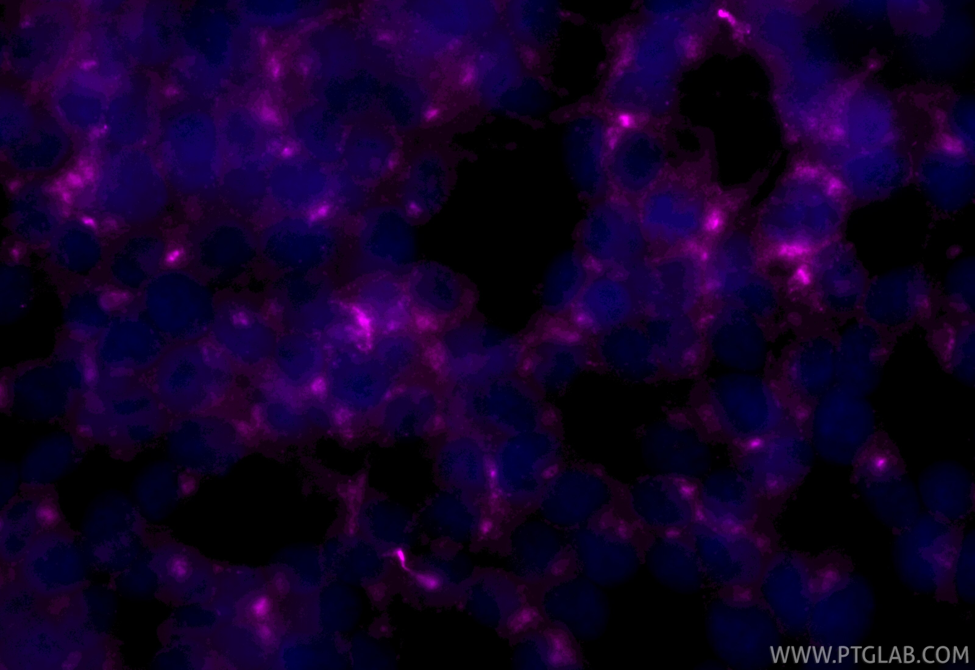 Immunofluorescence (IF) / fluorescent staining of SH-SY5Y cells using CoraLite® Plus 647-conjugated STMN2 Recombinant an (CL647-82925-2)