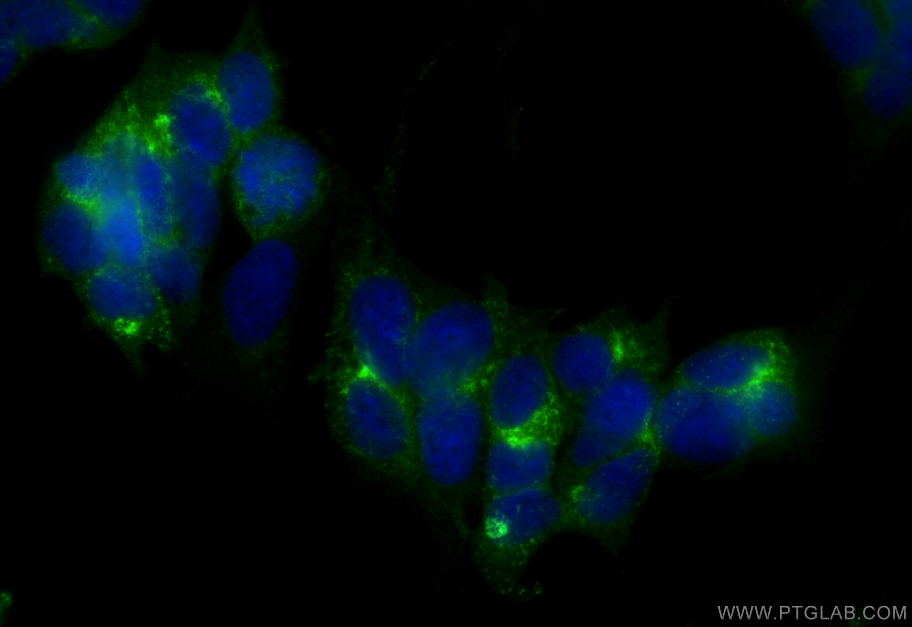 Immunofluorescence (IF) / fluorescent staining of SH-SY5Y cells using Multi-rAb™ STMN2 Multi-Recombinant antibody (RMX00021)