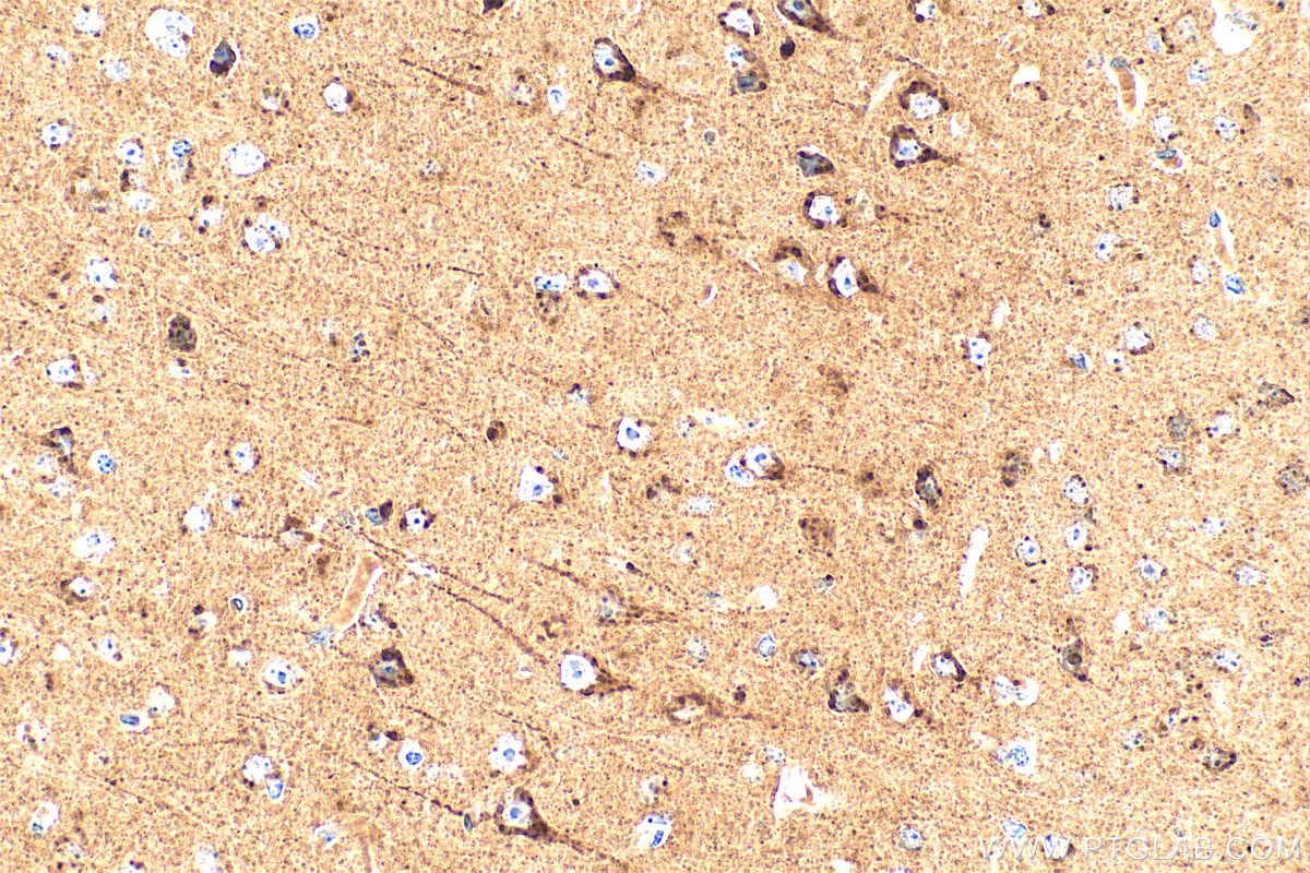 STMN2