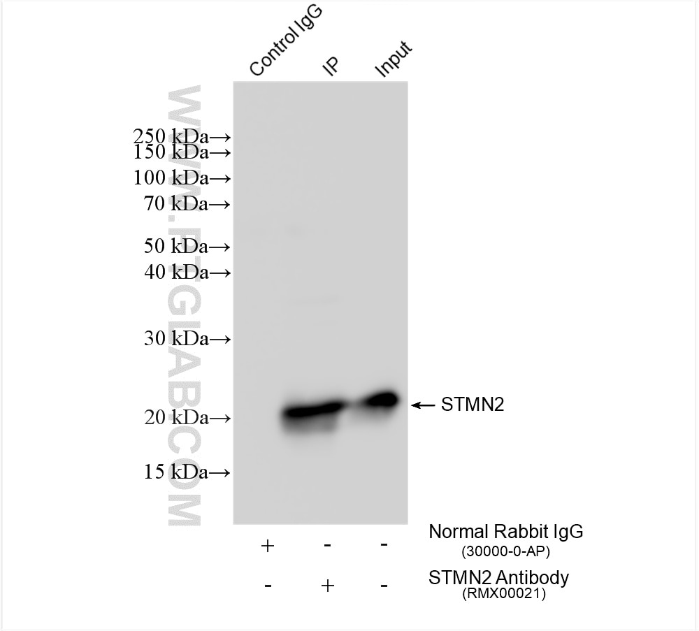 Immunoprecipitation (IP) experiment of Neuro-2a cells using Multi-rAb™ STMN2 Multi-Recombinant antibody (RMX00021)