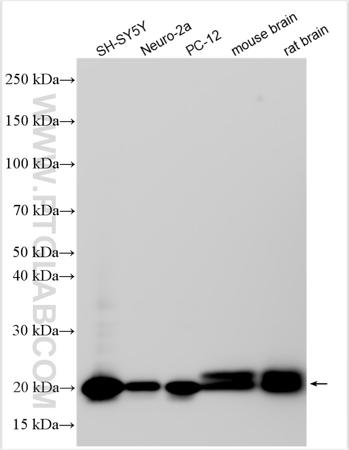 Western Blot (WB) analysis of various lysates using Multi-rAb™ STMN2 Multi-Recombinant antibody (RMX00021)