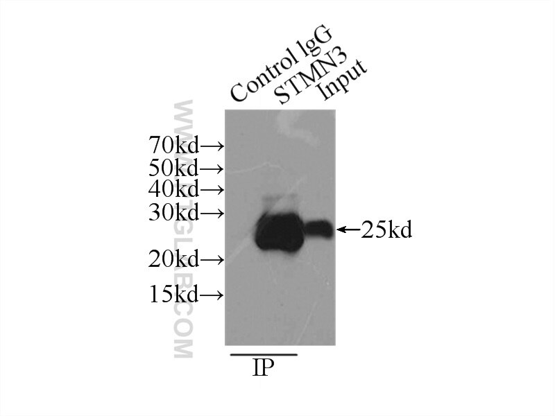 Immunoprecipitation (IP) experiment of mouse brain tissue using STMN3 Polyclonal antibody (11311-1-AP)