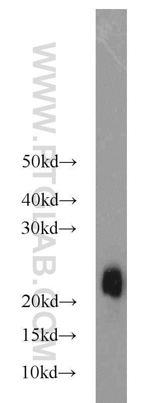 STMN3 Polyclonal antibody