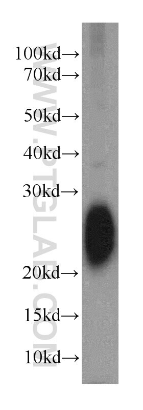 Western Blot (WB) analysis of rat brain tissue using STMN3 Polyclonal antibody (11311-1-AP)