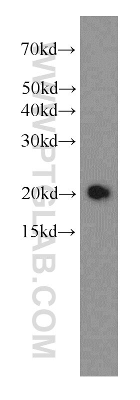 Western Blot (WB) analysis of human brain tissue using STMN3 Monoclonal antibody (66152-1-Ig)