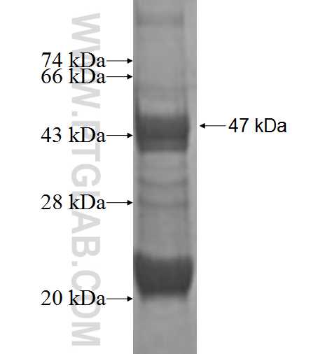 STMN3 fusion protein Ag1853 SDS-PAGE