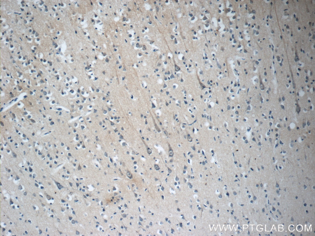 Immunohistochemistry (IHC) staining of human brain tissue using STMN4 Polyclonal antibody (12027-1-AP)