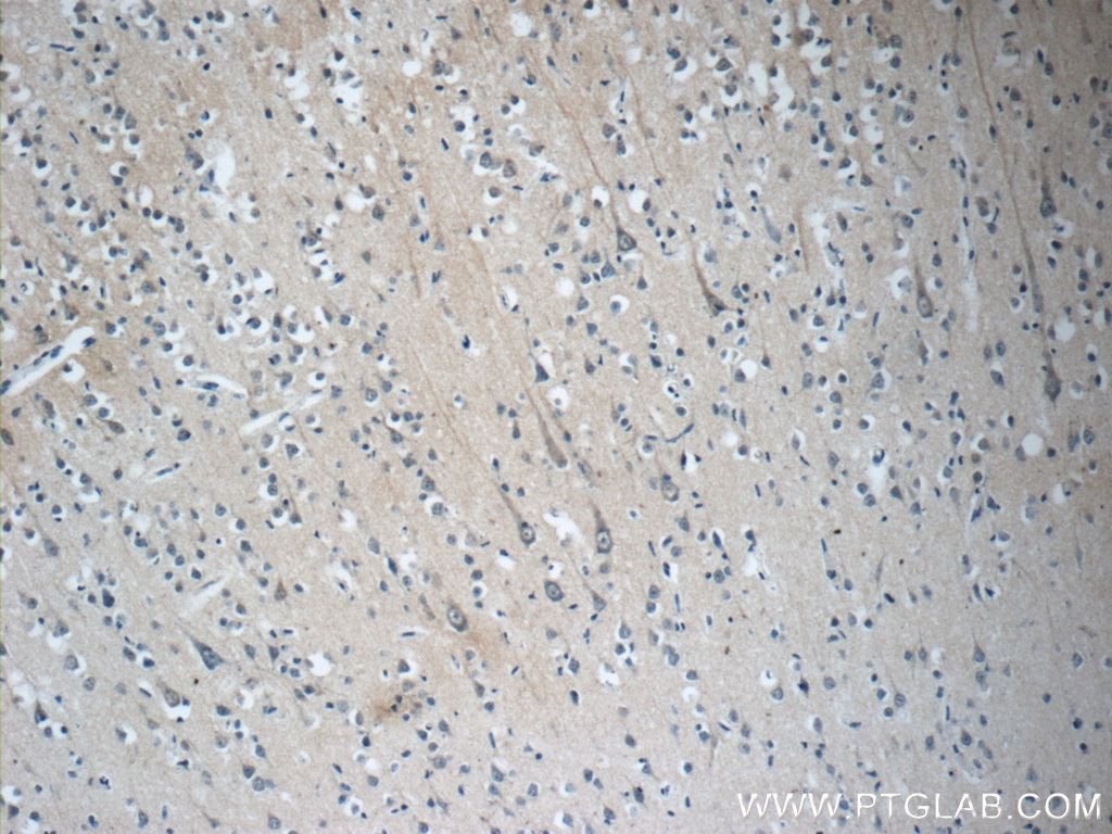 Immunohistochemistry (IHC) staining of human brain tissue using STMN4 Polyclonal antibody (12027-1-AP)