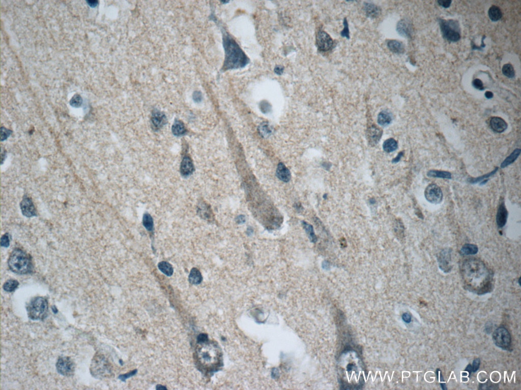 Immunohistochemistry (IHC) staining of human brain tissue using STMN4 Polyclonal antibody (12027-1-AP)