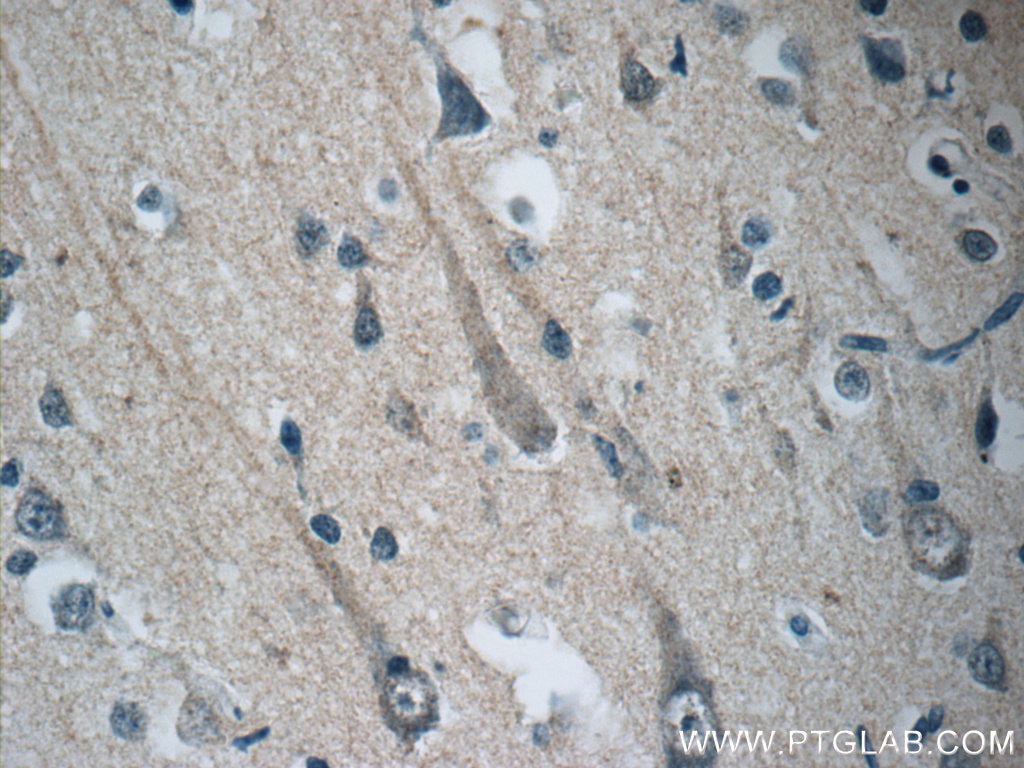 Immunohistochemistry (IHC) staining of human brain tissue using STMN4 Polyclonal antibody (12027-1-AP)
