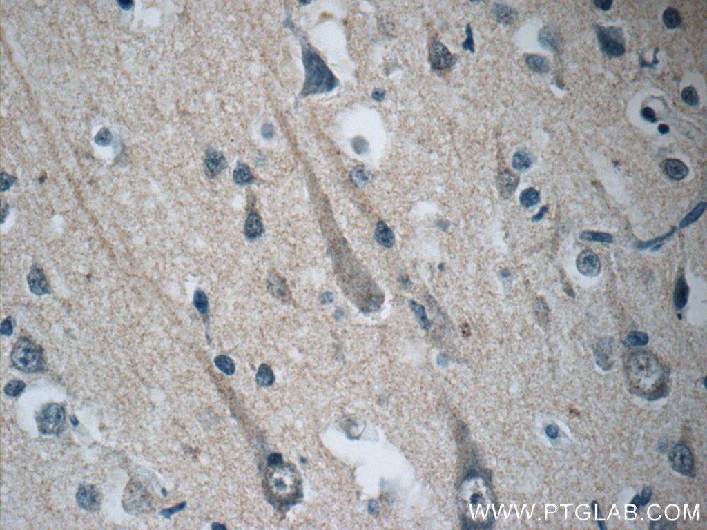 IHC staining of human brain using 12027-1-AP