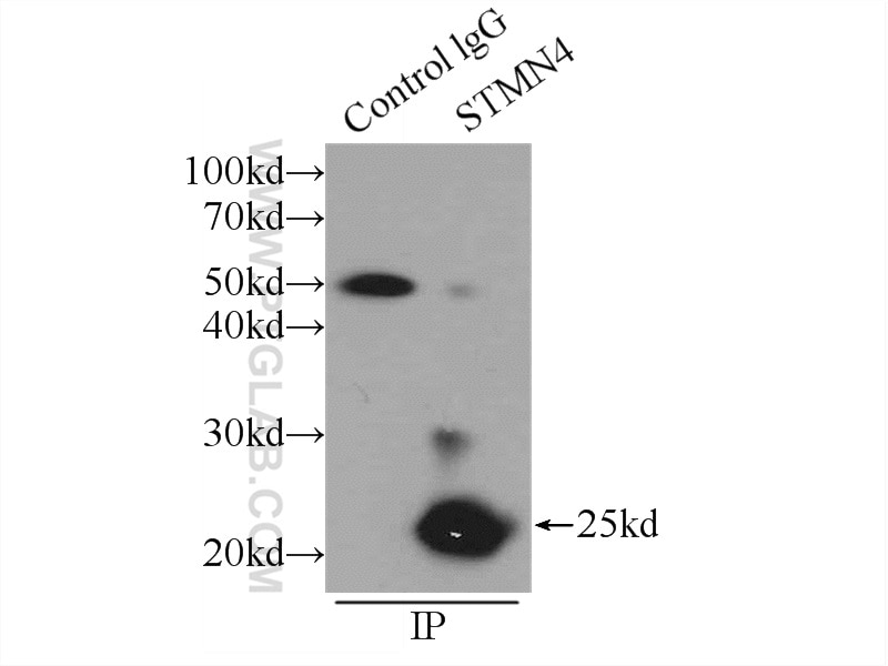 Immunoprecipitation (IP) experiment of mouse brain tissue using STMN4 Polyclonal antibody (12027-1-AP)