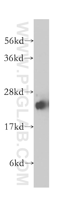 Western Blot (WB) analysis of human brain tissue using STMN4 Polyclonal antibody (12027-1-AP)