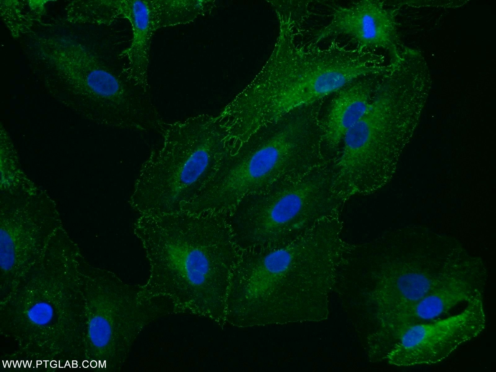 IF Staining of A549 using 12046-1-AP