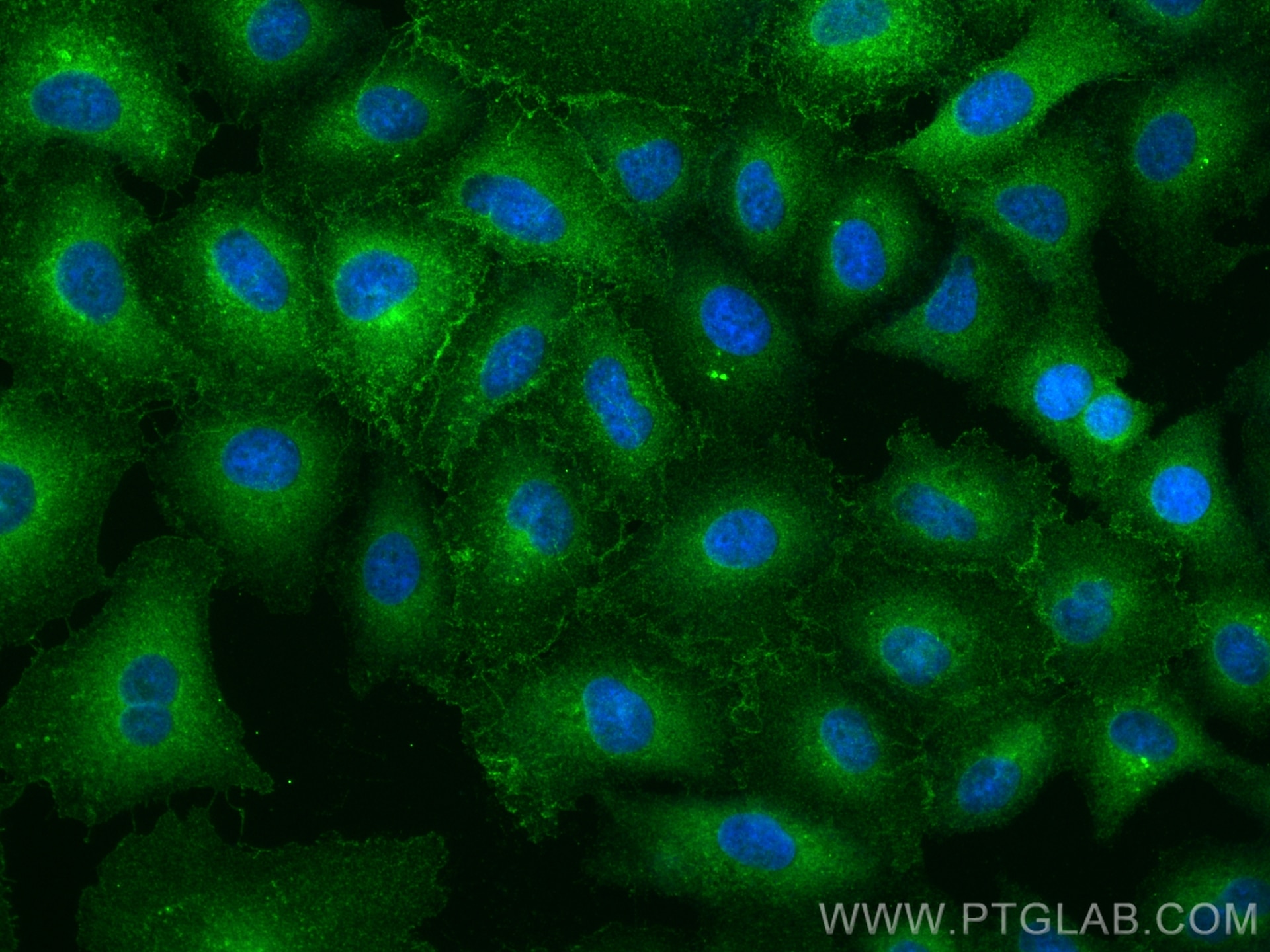 Immunofluorescence (IF) / fluorescent staining of A549 cells using Stomatin Polyclonal antibody (12046-1-AP)