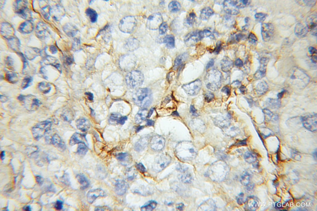 Stomatin Polyclonal antibody