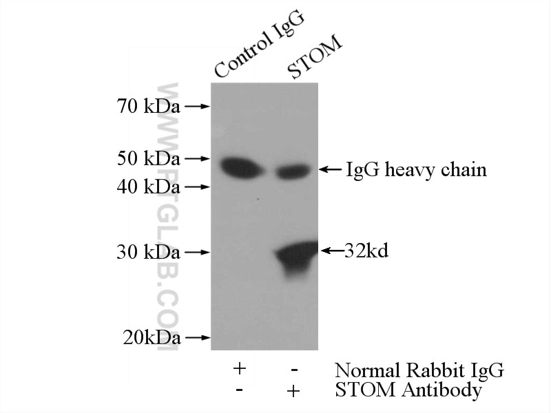 Immunoprecipitation (IP) experiment of HeLa cells using Stomatin Polyclonal antibody (12046-1-AP)