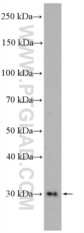 Western Blot (WB) analysis of A549 cells using Stomatin Polyclonal antibody (12046-1-AP)