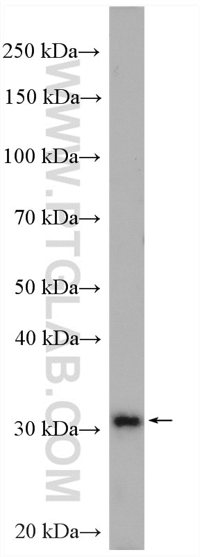 Western Blot (WB) analysis of HeLa cells using Stomatin Polyclonal antibody (12046-1-AP)