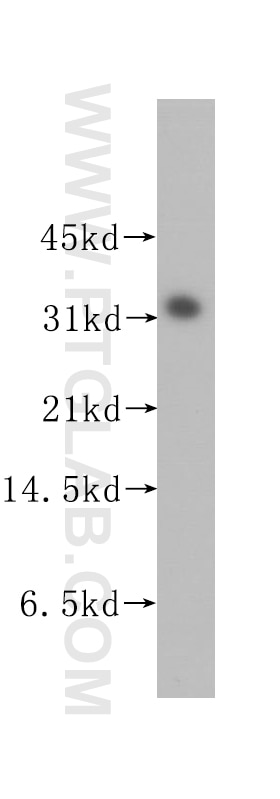 Stomatin Polyclonal antibody