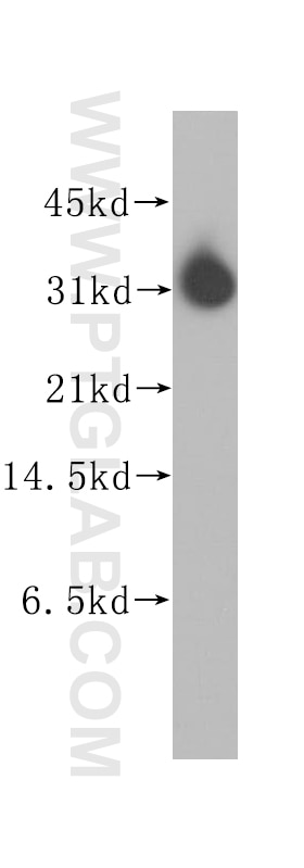 Western Blot (WB) analysis of human liver tissue using Stomatin Polyclonal antibody (12046-1-AP)