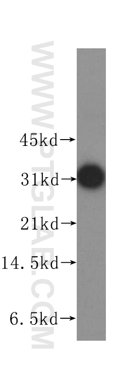 Western Blot (WB) analysis of human lung tissue using Stomatin Polyclonal antibody (12046-1-AP)