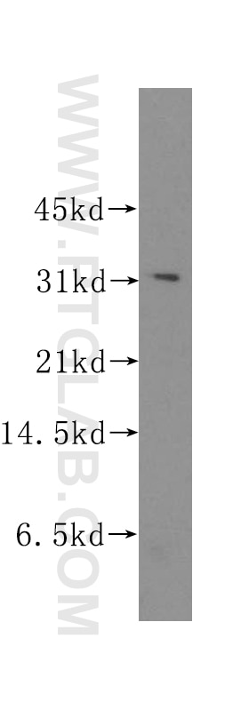 Western Blot (WB) analysis of K-562 cells using Stomatin Polyclonal antibody (12046-1-AP)