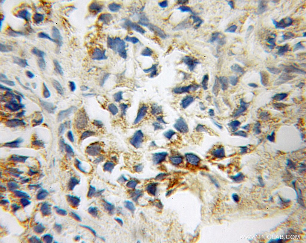 STOML1 Polyclonal antibody