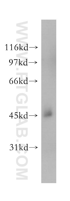 Western Blot (WB) analysis of human brain tissue using STOML1 Polyclonal antibody (12862-1-AP)