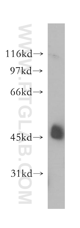 Western Blot (WB) analysis of A375 cells using STOML1 Polyclonal antibody (12862-1-AP)