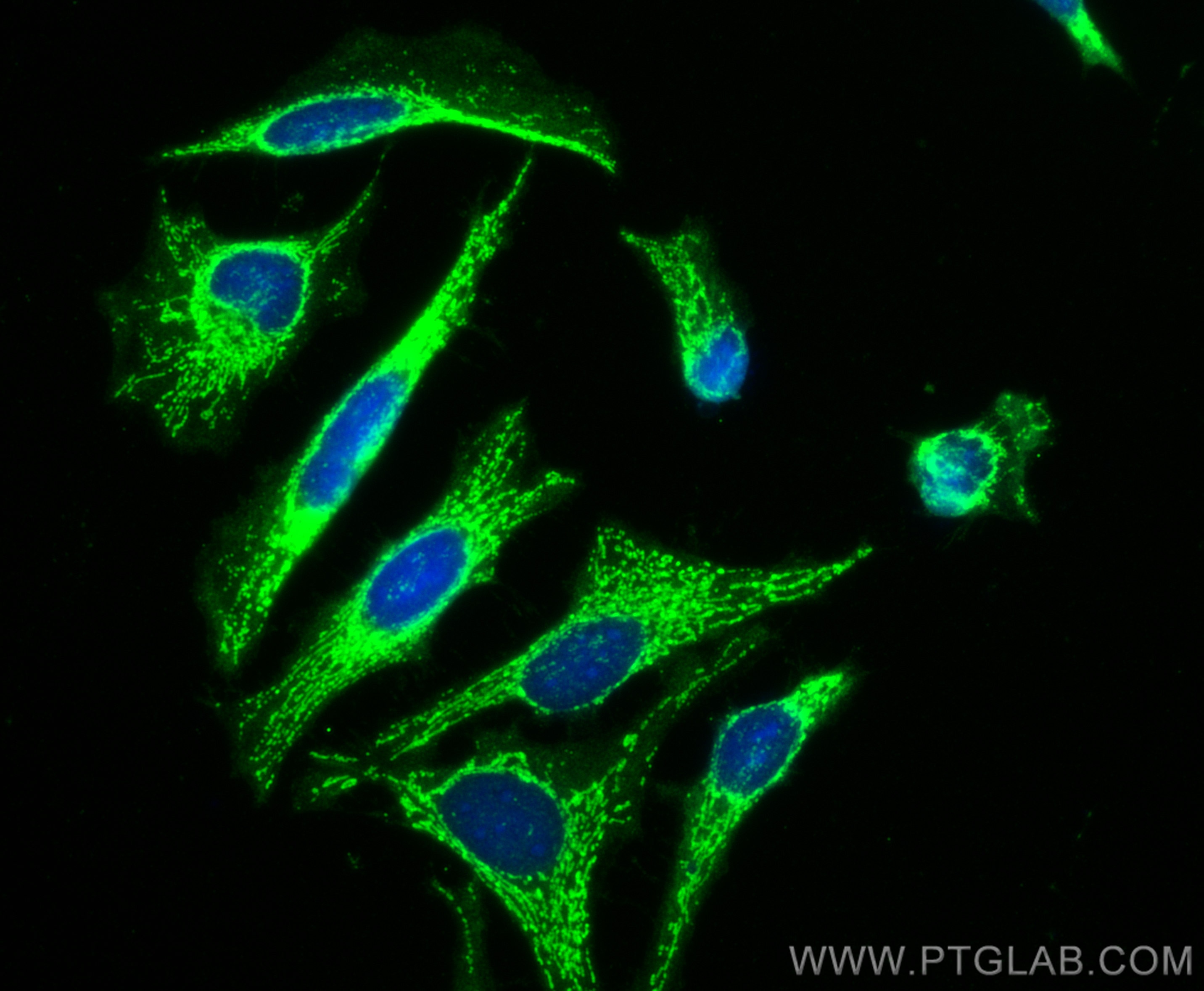 Immunofluorescence (IF) / fluorescent staining of HeLa cells using STOML2 Polyclonal antibody (10348-1-AP)