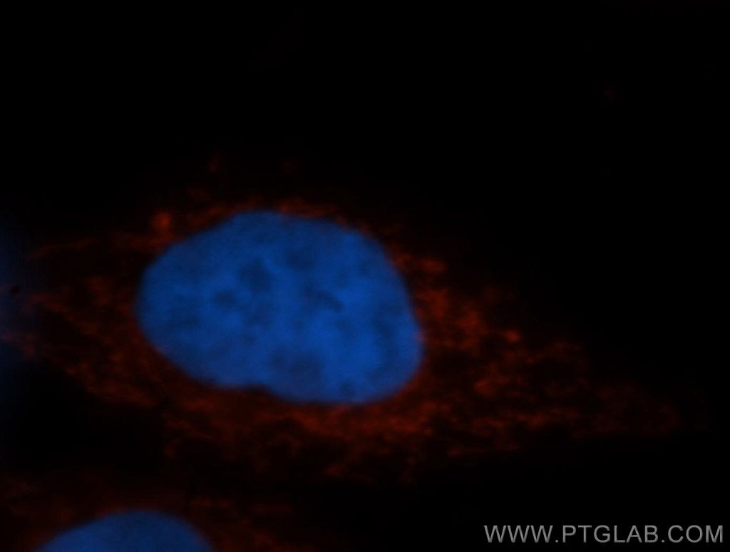 Immunofluorescence (IF) / fluorescent staining of MCF-7 cells using STOML2 Polyclonal antibody (10348-1-AP)