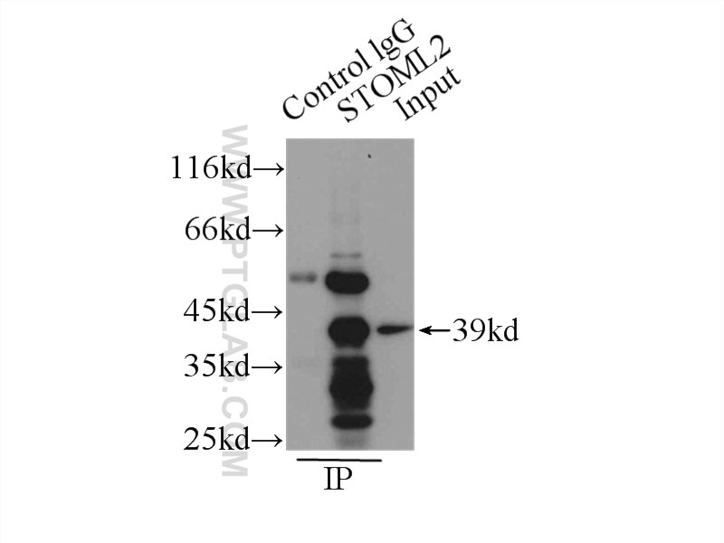 Immunoprecipitation (IP) experiment of mouse brain tissue using STOML2 Polyclonal antibody (10348-1-AP)
