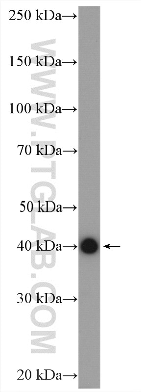 Western Blot (WB) analysis of HEK-293 cells using STOML2 Polyclonal antibody (10348-1-AP)
