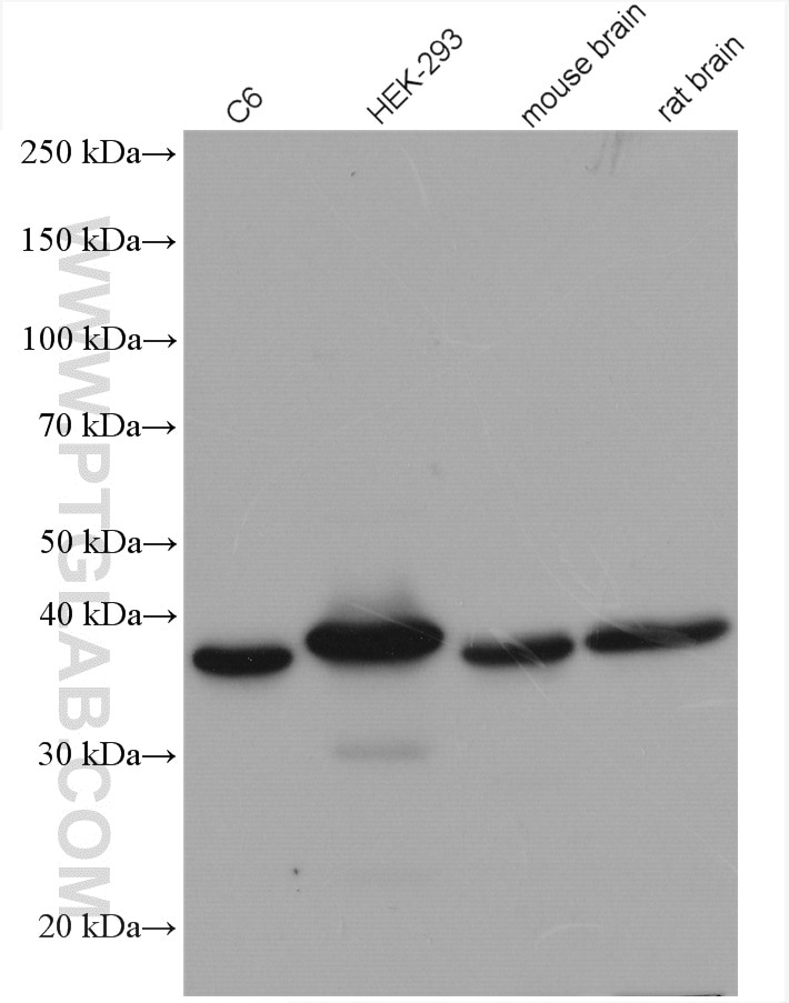 Western Blot (WB) analysis of various lysates using STOML2 Polyclonal antibody (10348-1-AP)