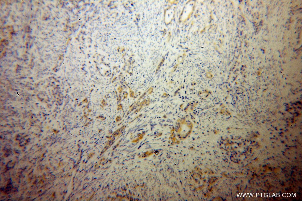 STOML2 Monoclonal antibody