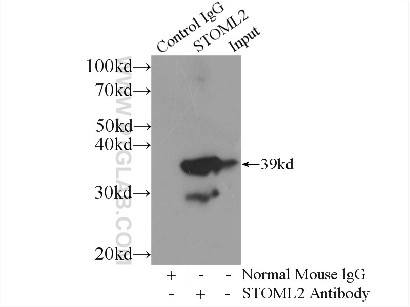 Immunoprecipitation (IP) experiment of mouse brain tissue using STOML2 Monoclonal antibody (60052-1-Ig)