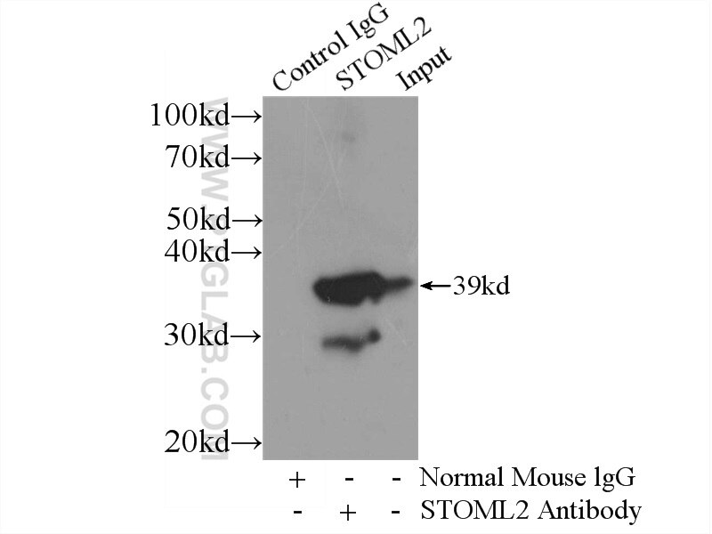 Immunoprecipitation (IP) experiment of mouse brain tissue using STOML2 Monoclonal antibody (60052-1-Ig)