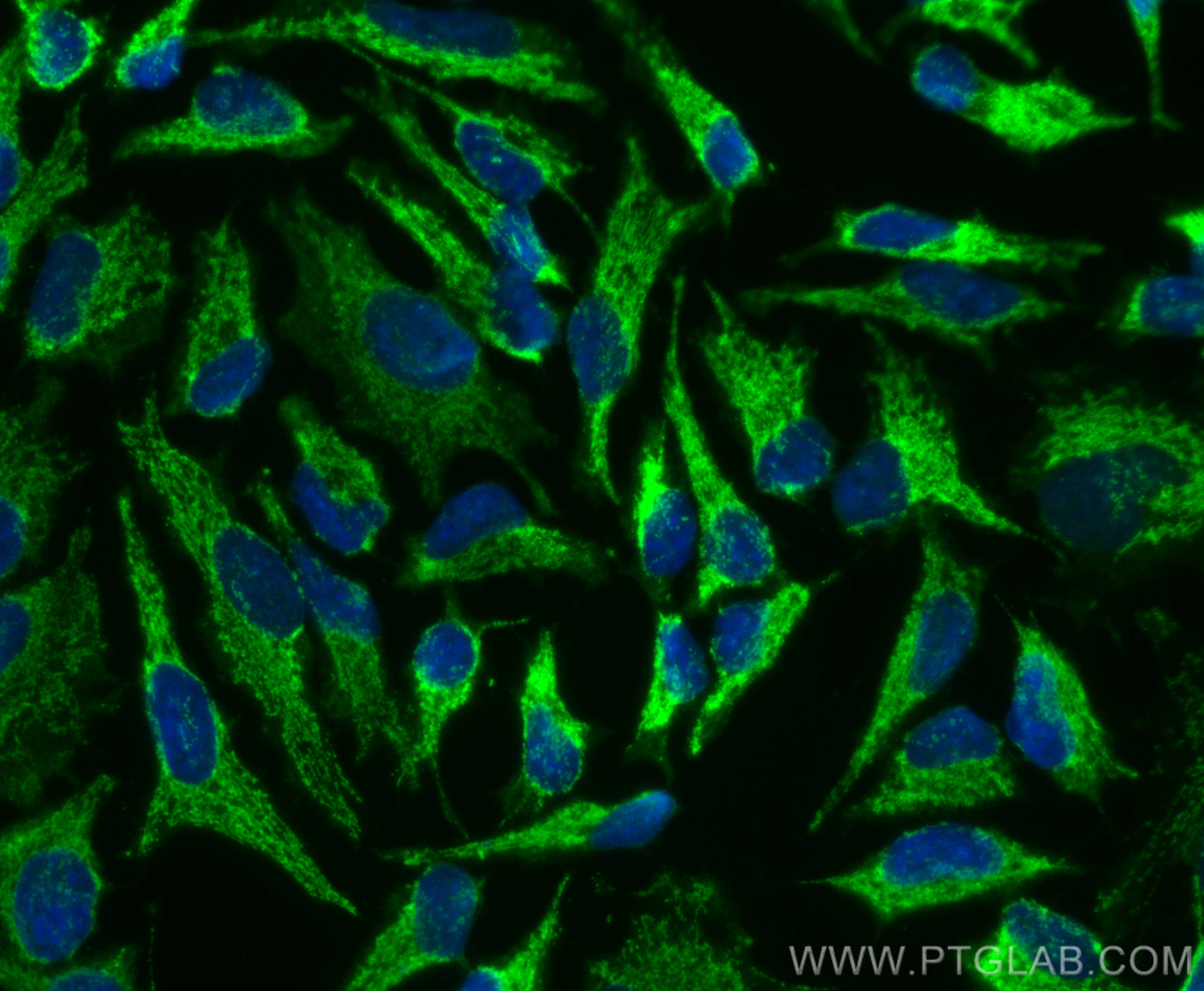 Immunofluorescence (IF) / fluorescent staining of HeLa cells using CoraLite® Plus 488-conjugated STOML2 Polyclonal an (CL488-10348)