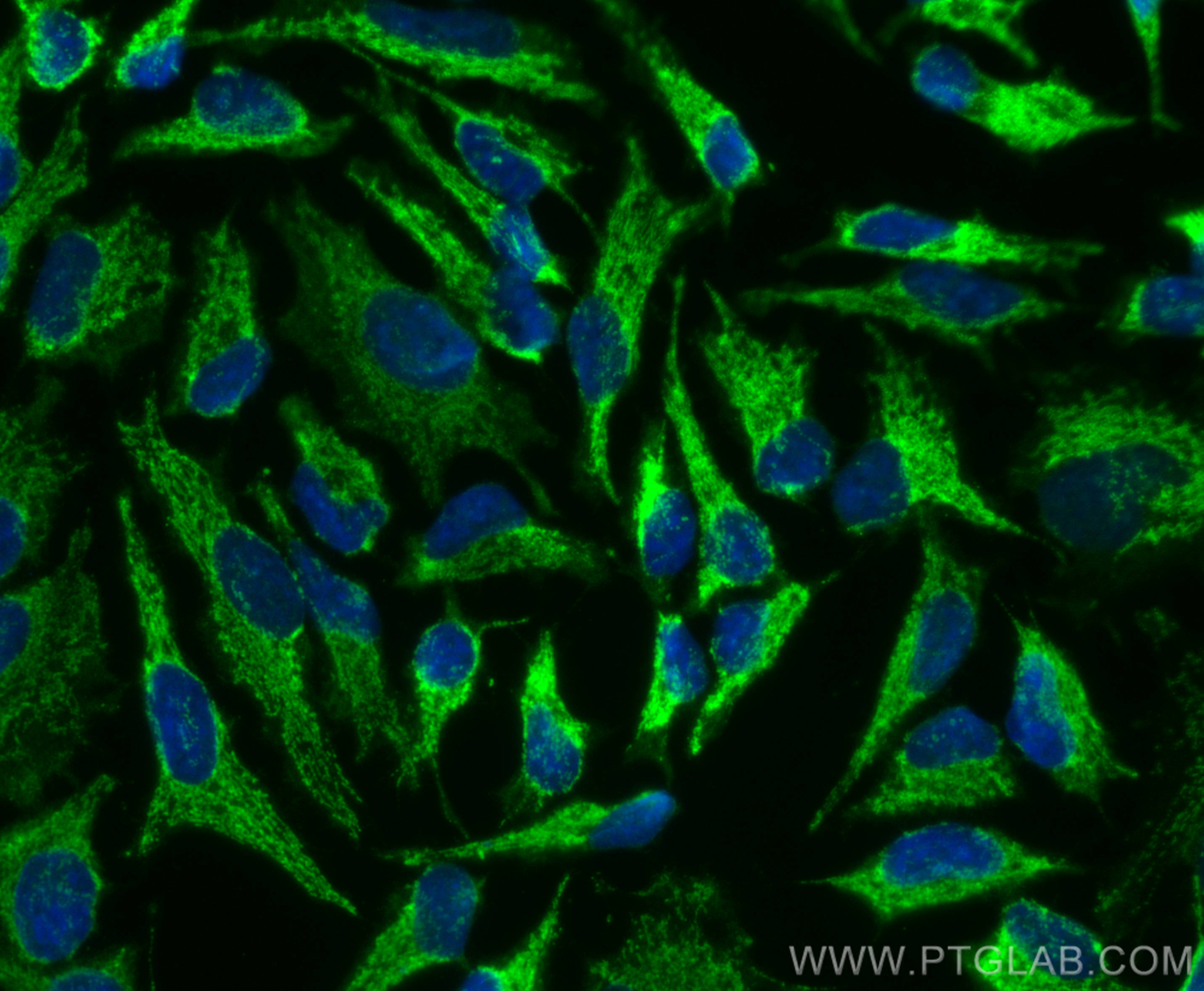 IF Staining of HeLa using CL488-10348