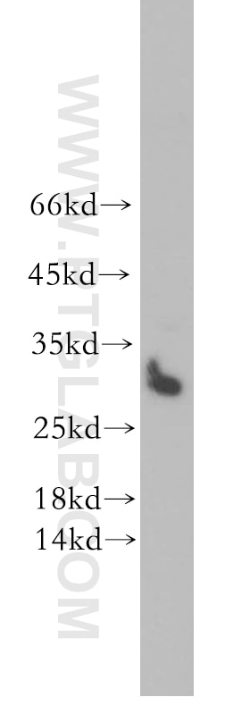 Western Blot (WB) analysis of HeLa cells using STOML3 Polyclonal antibody (13316-1-AP)