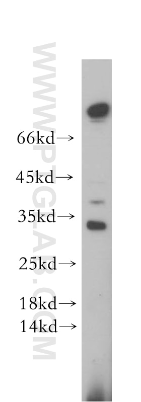 Western Blot (WB) analysis of SH-SY5Y cells using STOML3 Polyclonal antibody (13316-1-AP)