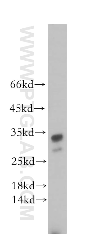 Western Blot (WB) analysis of MCF-7 cells using STOML3 Polyclonal antibody (13316-1-AP)