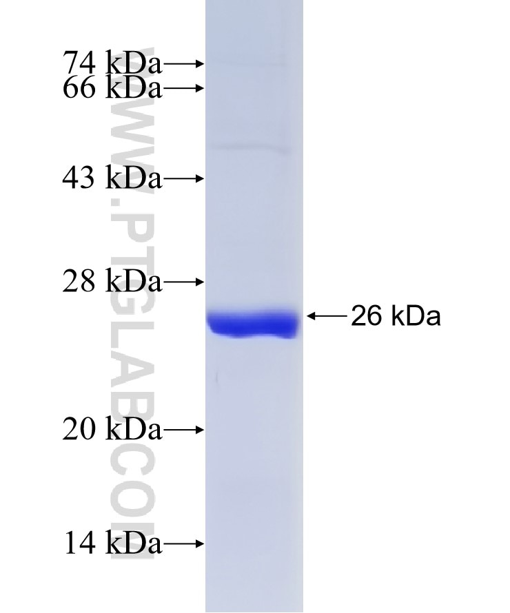 STOML3 fusion protein Ag4160 SDS-PAGE