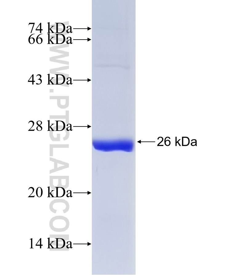 STOML3 fusion protein Ag4160 SDS-PAGE