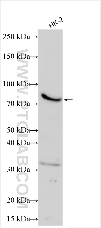Western Blot (WB) analysis of various lysates using STON1 Polyclonal antibody (55146-1-AP)