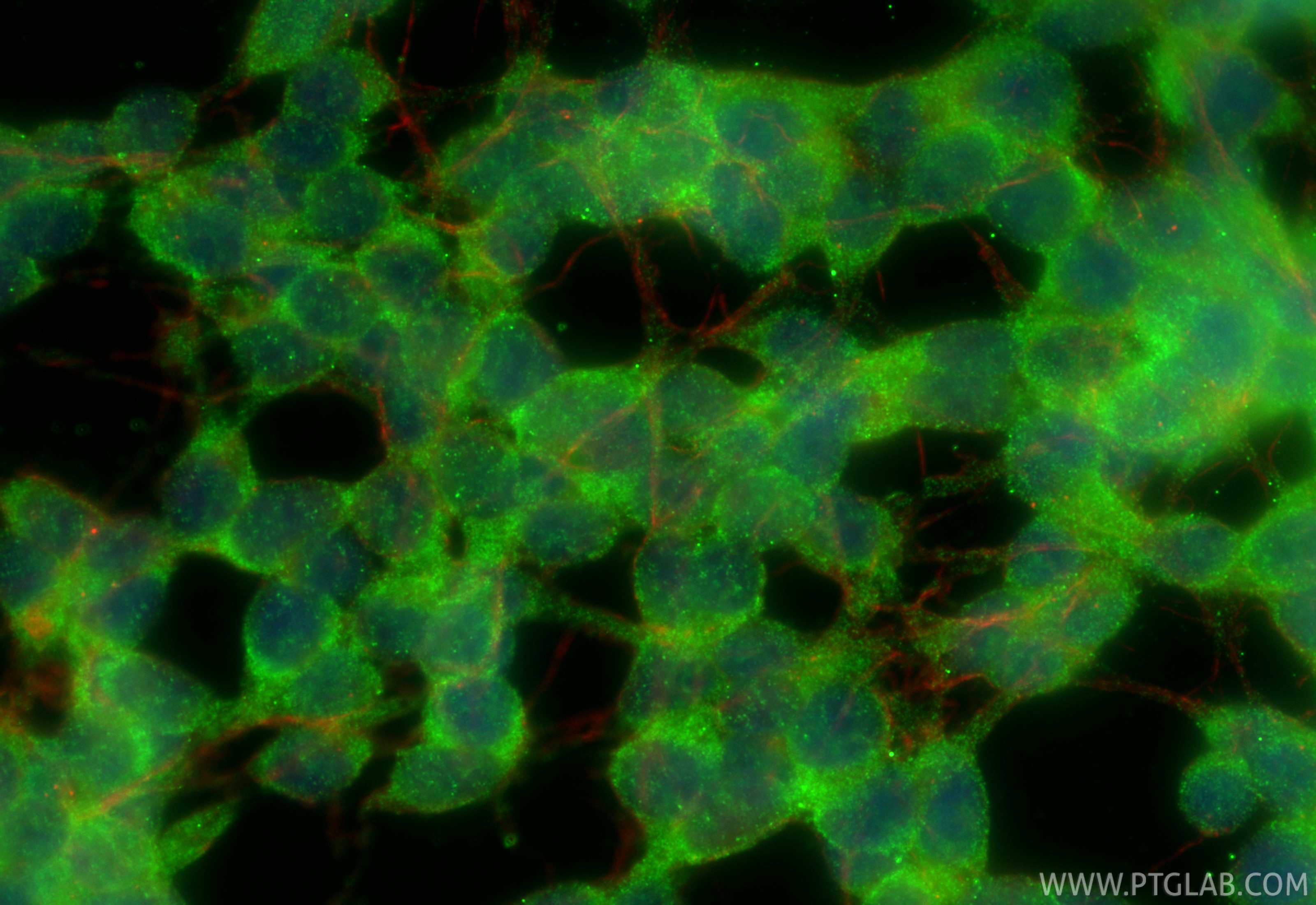 IF Staining of SH-SY5Y using 32724-1-AP (same clone as 32724-1-PBS) Immunofluorescence (IF) / fluorescent staining of SH-SY5Y cells using STOX2 Polyclonal antibody (32724-1-AP)