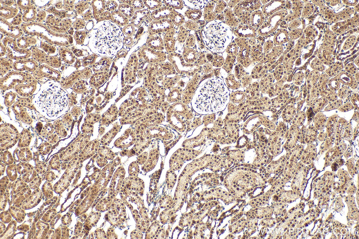 Immunohistochemistry (IHC) staining of rat kidney tissue using STOX2 Polyclonal antibody (32724-1-AP)