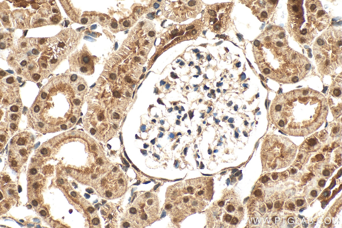 Immunohistochemistry (IHC) staining of rat kidney tissue using STOX2 Polyclonal antibody (32724-1-AP)